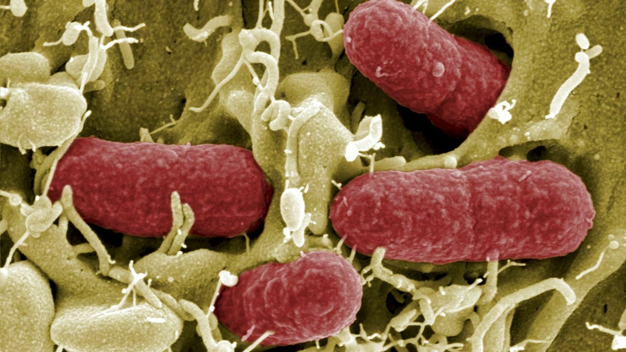 La bactérie ECEH sous la loupe des chercheurs européens.